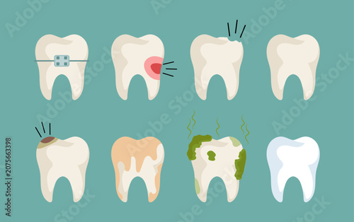 Set of Flat Cartoon Tooth Icons Demonstrating Dental Conditions and Treatments