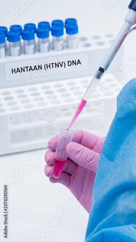 Close-up of a scientist in a blue gown and pink gloves using a pipette to transfer pink fluid into a microtube. Hantaan HTNV DNA research on virus vaccine in a modern sterile laboratory.