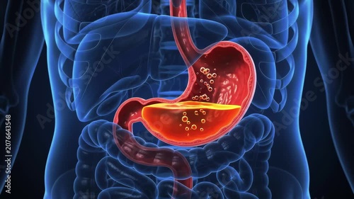 3D medical animation of stomach acid reflux with gastric acid bubbles heartburn GERD digestion anatomy inside human body