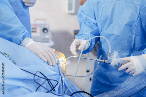 фотографія Knee Arthroscopy Procedure with Meniscus Repair Tools in Surgery