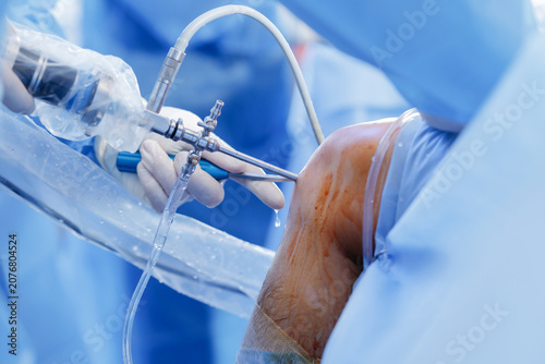 Foto Knee Arthroscopy Procedure with Meniscus Repair Tools in Surgery
