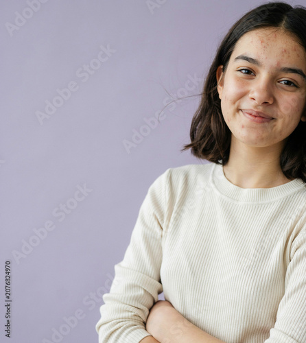 Smiling Teenage Girl with Acne and Crossed Arms on Purple Background