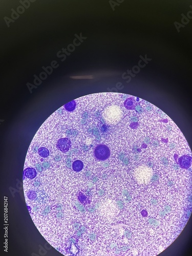 Mast cell tumour