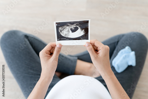 Bild auf Leinwand pregnant woman is looking at an ultrasound photo of fetus