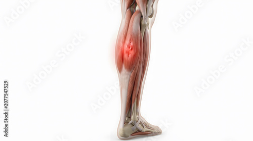 3D Illustration of Human Leg Muscles with Highlighted Pain Area