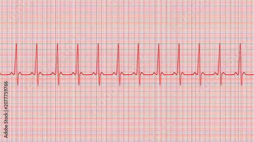 Electrocardiogram of Healthy Heartbeat: A close-up view of a red electrocardiogram (ECG) showing a regular and healthy heartbeat pattern, displayed on a grid paper background.