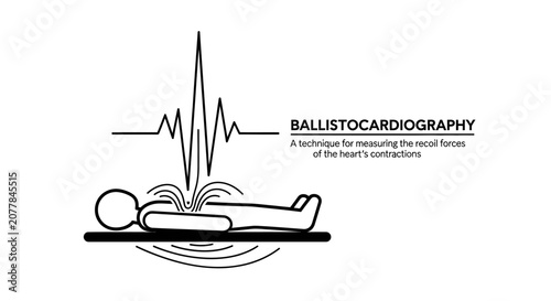 Obraz na plátně Line art illustration of ballistocardiography, a technique for measuring the recoil forces of the heart's contractions, showing a patient with graphical monitoring