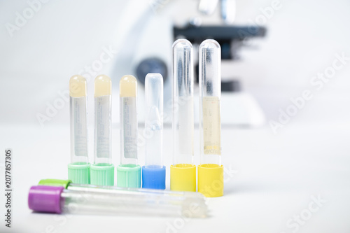 Row of upside down medical test tubes with colorful caps on white background, blurred laboratory microscope in background.