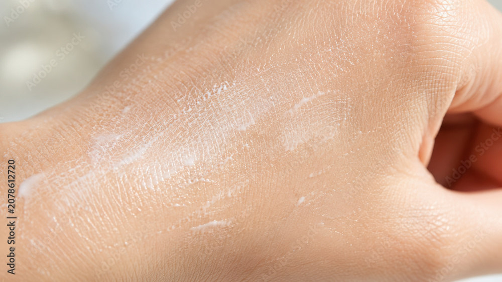 Fototapeta premium Hand moisture barrier cream on dry skin closeup skincare texture protective lotion hydration concept soft feel tender care focus detail macro view