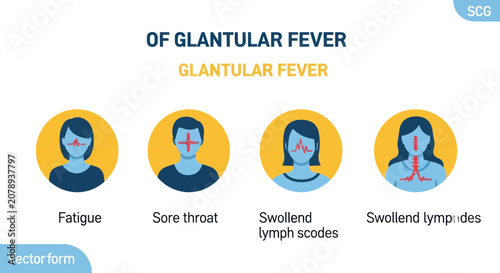 Fotografija Medical infographic showing symptoms of glandular fever in people