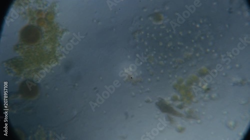 Water sample under microscope showing microorganisms and contaminants in detailed scientific close up observation