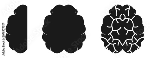 Bild auf Leinwand human brain