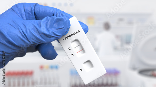 Fotografie Urinary antigen test (UAT) is the primary and fastest method for diagnosing legionellosis
