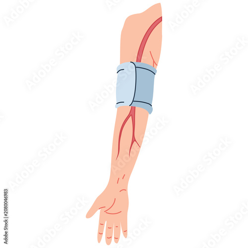 Quadro su tela Human arm displaying superficial arteries with a blood pressure cuff encircling the limb