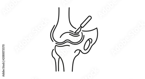 Knee Arthroscopy Surgery Icon: Medical Procedure, Orthopedic Joint Repair, Surgical Instrument