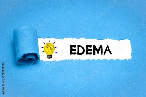 Foto Edema