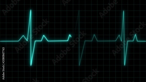Glowing heart monitor line on a dark grid screen, showing a steady heartbeat rhythm. Clean medical background for health, emergency, hospital, and technology themes.