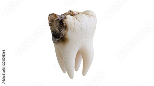 Konstfotografi Decayed human molar tooth with dark cavities, isolated on transparent background