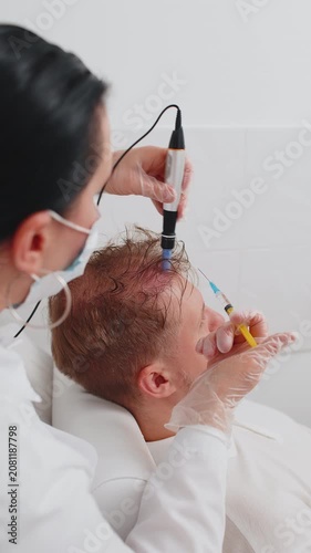 Alopecia. Man hair loss improve growth treatment regeneration dermapen microneedling vitamin exosomes plasma syringe injections. Trichologist cosmetologist doctor head procedure fractional mesotherapy
