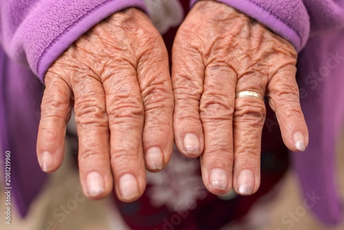Close up of wrinkled hands of an elderly woman wearing a wedding ring