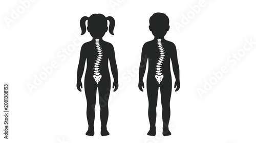 Photos Black silhouettes of a young boy and girl showing medical spinal scoliosis on wh