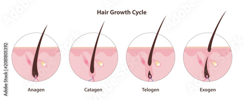 Obraz na plátně Hair growth cycle vector icon set illustration