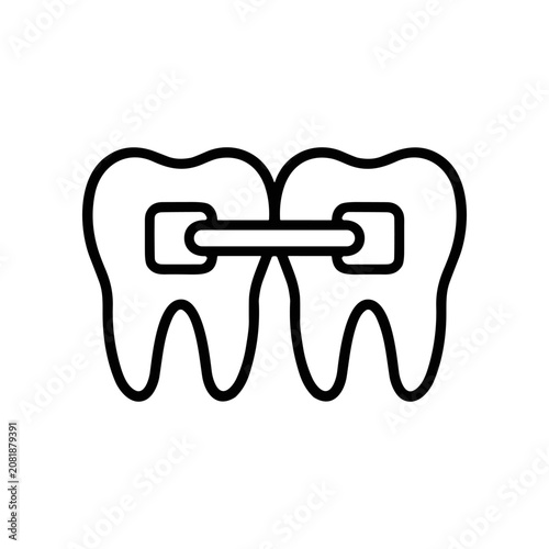 Orthodontic dental braces on teeth.