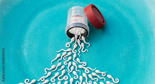 White sperm models pour out from an open medical specimen cup labeled 