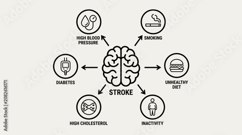 Schilderij op canvas Stroke Risk Factors Outline Line Art Vector Illustration