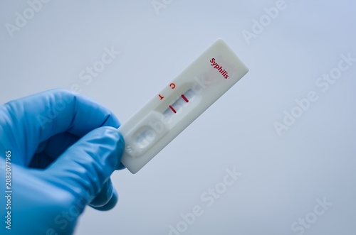 Blood sample of patient positive result for syphilis.