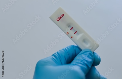 The sample of patient positive result for vibrio.