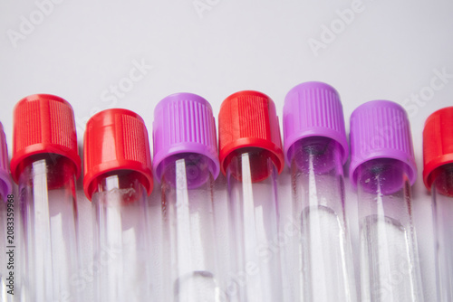 Cuadro en lienzo Close-up, high-angle shot of several empty medical blood collection tubes with alternating red and purple caps, arranged in a row against a light background