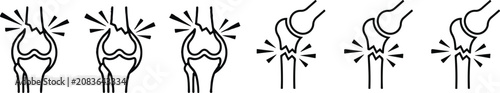 Foto Knee pain illustration set six line art depictions of joint discomfort and injury on white background