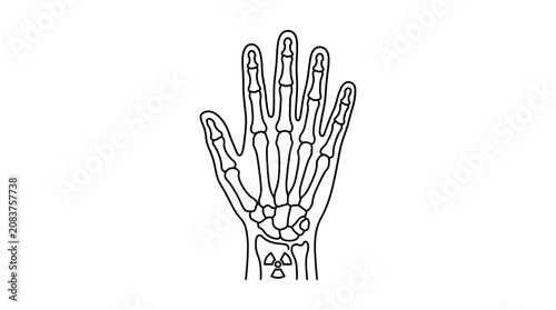 Tableau sur toile Human Hand Skeleton X-ray Illustration with Radiation Symbol