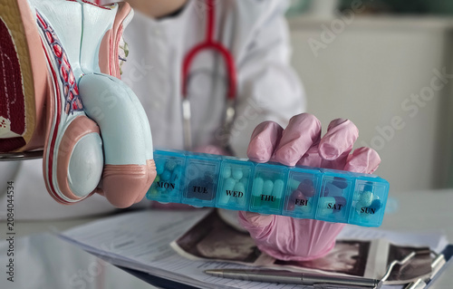 Bild auf Leinwand Doctor shows a model of male reproductive organ with a pill organizer in a medic