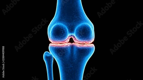 3D medical animation of human knee joint anatomy with blue x-ray style bones and highlighted meniscus cartilage on a black background.