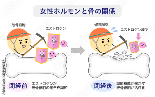 Fotografía 女性ホルモンのエストロゲンと骨密度の関係を表すイラスト