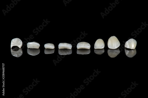 ceramic crowns and veneers