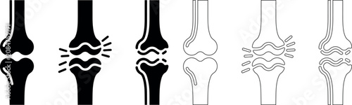 Foto Knee joint pain anatomy illustrations in various styles and colors