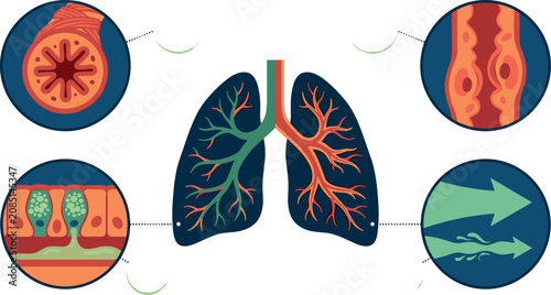 Quadro su tela Human Respiratory System Lung Anatomy Diagram Showing Bronchial Airway Cross Sec