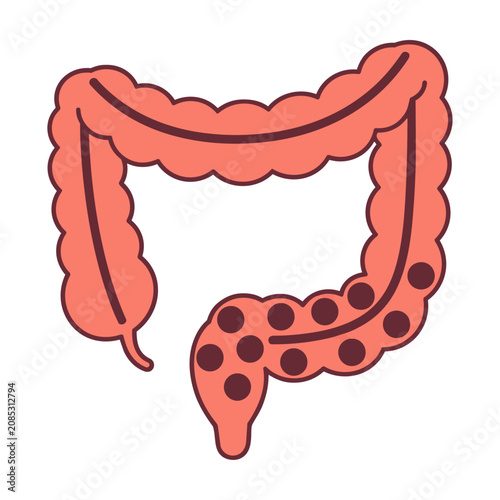 Simplified medical diagram of a human colon with dark nodules on a white background representing digestive health. Healthcare and medical concept