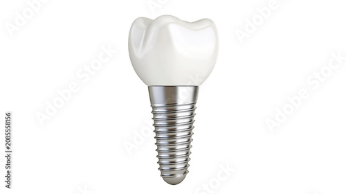 Bild auf Leinwand Dental implant with white crown and metallic screw base