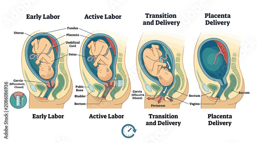 Canvastavla Stages of Childbirth: Labor, Delivery, and Placenta Expulsion