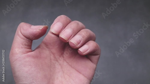 Close up detail of a woman's hand showing long, uncut, dry, and dirty fingernails, isolated on gray background.