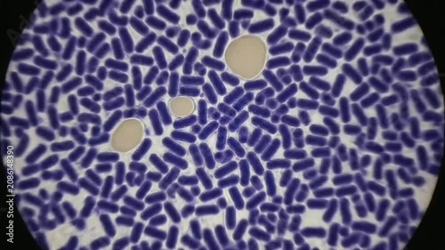 Observing Purple Bacillus Bacteria Under Magnified Microscope