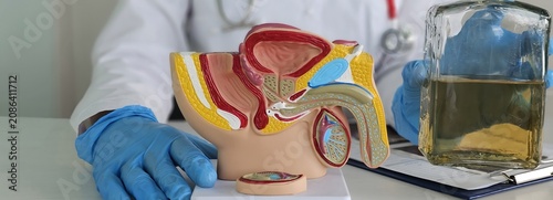 Fotografia Urological anatomical model of the male reproductive system with a bottle of alc