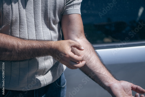 Canvas Print A person's hands itch. Close-up.