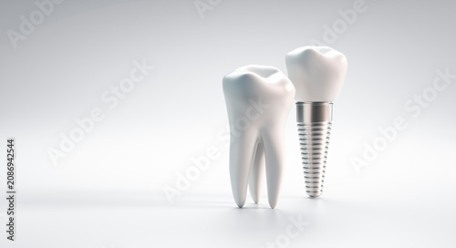 Photos Dental implant and molar tooth isolated on white background with copy space - 3D