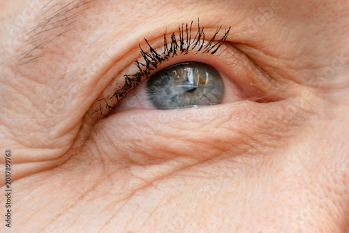 middle aged female's eye with drooping eyelid. Ptosis is a drooping of the upper eyelid, lazy eye. Cosmetology and facial concept, first wrinkles.