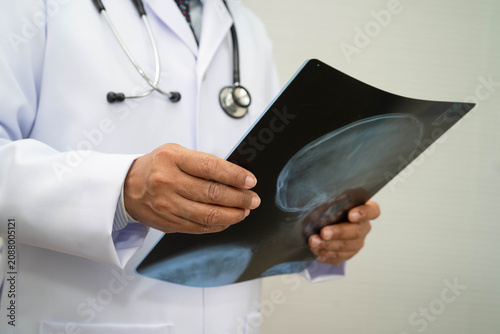 Bild auf Leinwand Doctor examining brain radiography xray film.